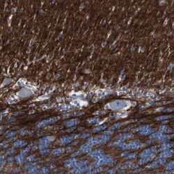 IGSF8/CD316 Antibody, Novus Biologicals 0.1mL; Unlabeled:Antibodies, Polyclonal