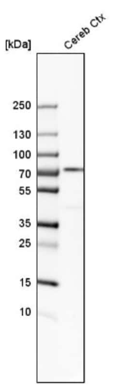 IGSF8/CD316 Antibody, Novus Biologicals 0.1mL; Unlabeled:Antibodies, Polyclonal