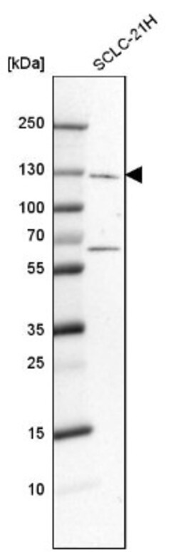 IGSF9 Antibody, Novus Biologicals 0.1mL; Unlabeled:Antibodies, Polyclonal