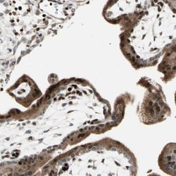 IHPK2 Antibody, Novus Biologicals 0.1mL; Unlabeled:Antibodies, Polyclonal