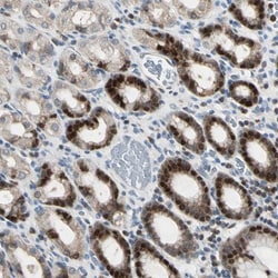 IHPK2 Antibody, Novus Biologicals 0.1mL; Unlabeled:Antibodies, Polyclonal