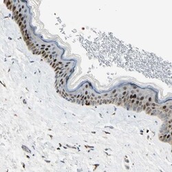 IHPK2 Antibody, Novus Biologicals 0.1mL; Unlabeled:Antibodies, Polyclonal