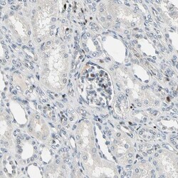 IHPK2 Antibody, Novus Biologicals 0.1mL; Unlabeled:Antibodies, Polyclonal