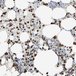 IKB zeta Antibody, Novus Biologicals 25 &mu;L; Unlabeled:Antibodies, Polyclonal