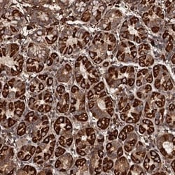 IKIP Antibody, Novus Biologicals 25 &mu;L, Unconjugated:Antibodies, Polyclonal