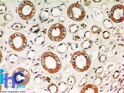 IKK alpha Antibody (14A231) - BSA Free, Novus Biologicals 0.025mg; Unlabeled:Antibodies,