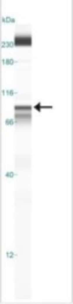 IKK beta Antibody (10A9B6) - BSA Free, Novus Biologicals 0.1mg; Unlabeled:Antibodies,