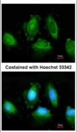 IKK epsilon/IKBKE Antibody, Novus Biologicals 0.1mg; Unlabeled:Antibodies,