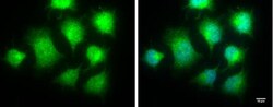 IKK epsilon/IKBKE Antibody, Novus Biologicals 0.1mg; Unlabeled:Antibodies,