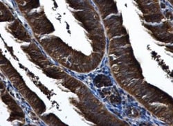 IKK epsilon/IKBKE Antibody, Novus Biologicals 0.1mg; Unlabeled:Antibodies,