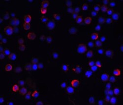 IKK gamma Antibody - BSA Free, Novus Biologicals 0.1mg; Unlabeled:Antibodies,