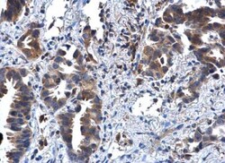 IL-1 RII Antibody, Novus Biologicals 0.1mg; Unlabeled:Antibodies, Polyclonal