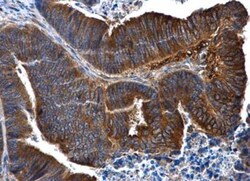 IL-1 RII Antibody, Novus Biologicals 0.1mg; Unlabeled:Antibodies, Polyclonal