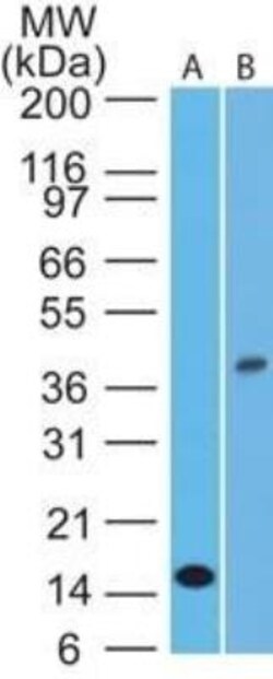 IL-1 beta/IL-1F2 Antibody (43N3D8) - BSA Free, Novus Biologicals 0.1mg;