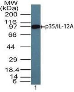 IL-12 p70/IL-12A Antibody, Novus Biologicals:Antibodies:Primary Antibodies