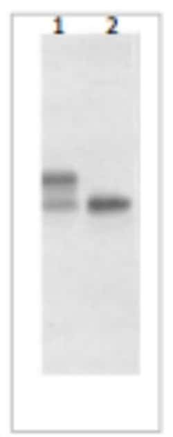 IL-17/IL-17A Antibody (408H6.01/mAb25), Novus Biologicals 0.1mg; Unlabeled:Antibodies,