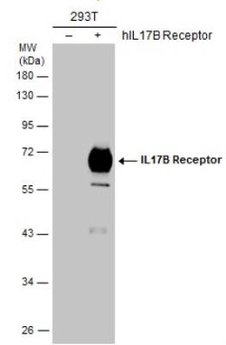 IL-17RB Antibody, Novus Biologicals 0.1mL:Antibodies, Polyclonal