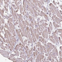 IL-18 BPa/IL18BP Antibody, Novus Biologicals:Antibodies:Primary Antibodies