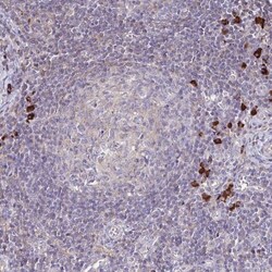 IL-18 BPa/IL18BP Antibody, Novus Biologicals:Antibodies:Primary Antibodies