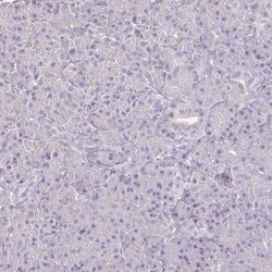 IL-18 BPa/IL18BP Antibody, Novus Biologicals:Antibodies:Primary Antibodies