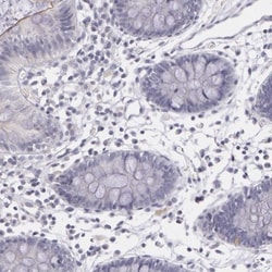 IL-1ra/IL-1F3/IL1RN Antibody, Novus Biologicals 0.1mL; Unlabeled:Antibodies,