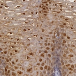 IL-1ra/IL-1F3/IL1RN Antibody, Novus Biologicals 0.1mL; Unlabeled:Antibodies,