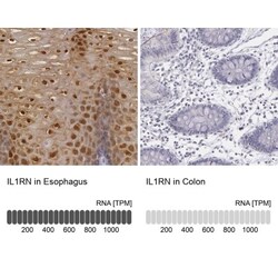 IL-1ra/IL-1F3/IL1RN Antibody, Novus Biologicals 0.1mL; Unlabeled:Antibodies,