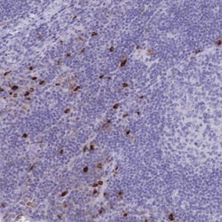 IL-2 R beta Antibody, Novus Biologicals 25 μL, Unlabeled:Antibodies,