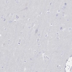 IL-2 R beta Antibody, Novus Biologicals 25 μL, Unlabeled:Antibodies,