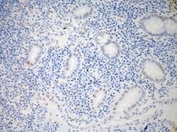 IL-23R Antibody (15N6C6), Novus Biologicals:Antibodies:Primary Antibodies