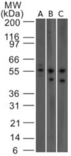 IL-23R Antibody (15N6C6), Novus Biologicals:Antibodies:Primary Antibodies
