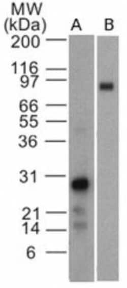 EBI3 Antibody (42N1G4), Novus Biologicals 0.1mg; Unlabeled:Antibodies,