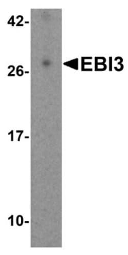 EBI3 Antibody - BSA Free, Novus Biologicals 0.1mg; Unlabeled:Antibodies,