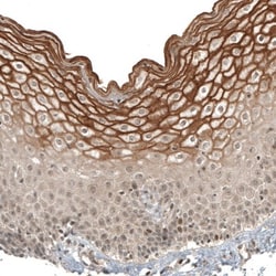 IL-28R alpha/IFN-lambda R1 Antibody, Novus Biologicals:Antibodies:Primary