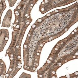 IL-28R alpha/IFN-lambda R1 Antibody, Novus Biologicals:Antibodies:Primary