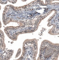 IL-28R alpha/IFN-lambda R1 Antibody, Novus Biologicals:Antibodies:Primary