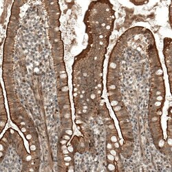 IL-28R alpha/IFN-lambda R1 Antibody, Novus Biologicals:Antibodies:Primary