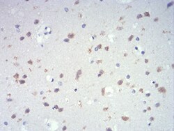 IL-28A/IFN-lambda 2 Antibody (7B9A4) - BSA Free, Novus Biologicals 0.1mg;