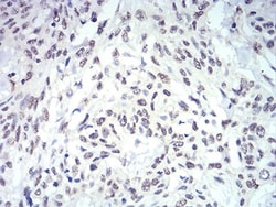 IL-28A/IFN-lambda 2 Antibody (7B9A4) - BSA Free, Novus Biologicals 0.1mg;