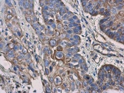 IL-3R alpha/CD123 Antibody, Novus Biologicals 0.1mL; Unlabeled:Antibodies,