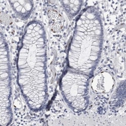 IL-33 Antibody, Novus Biologicals 0.1mL; Unlabeled:Antibodies, Polyclonal