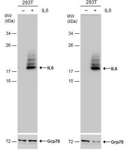 IL-6 Antibody, Novus Biologicals 0.1mL; Unlabeled:Antibodies, Polyclonal