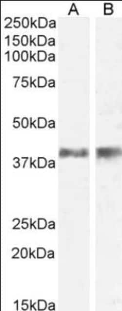 IL12B Antibody, Novus Biologicals 0.1mg; Unlabeled:Antibodies, Polyclonal