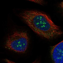 IL17REL Antibody, Novus Biologicals 0.1mL; Unlabeled:Antibodies, Polyclonal