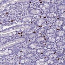 IL17REL Antibody, Novus Biologicals 0.1mL; Unlabeled:Antibodies, Polyclonal