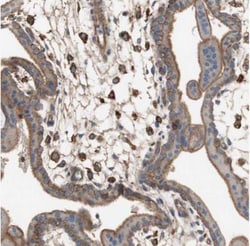 ST2/IL-33R Antibody, Novus Biologicals:Antibodies:Primary Antibodies