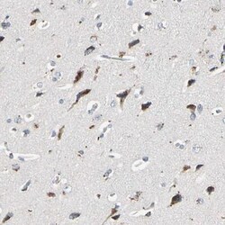 ST2/IL-33R Antibody, Novus Biologicals 0.1mL; Unlabeled:Antibodies, Polyclonal