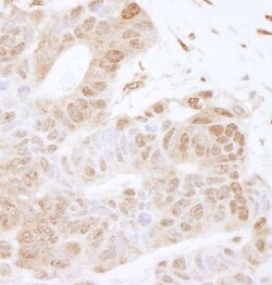 ILF1 Antibody, Novus Biologicals 0.1mL; Unlabeled:Antibodies, Polyclonal