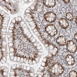 ILF1 Antibody, Novus Biologicals 25 &mu;L; Unlabeled:Antibodies, Polyclonal