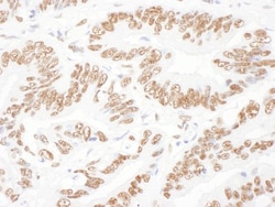 ILF2 Antibody, Novus Biologicals 0.1mg; Unlabeled:Antibodies, Polyclonal